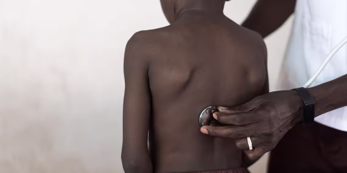 Study Reveals Millions of African Teenagers Suffer from Undiagnosed Asthma