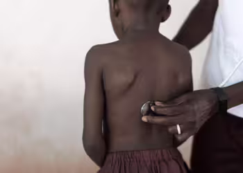 Study Reveals Millions of African Teenagers Suffer from Undiagnosed Asthma