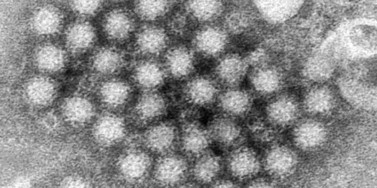Understanding Norovirus: A Guide to Symptoms, Risks, and Prevention - (Charles D. Humphrey/CDC via AP, File)