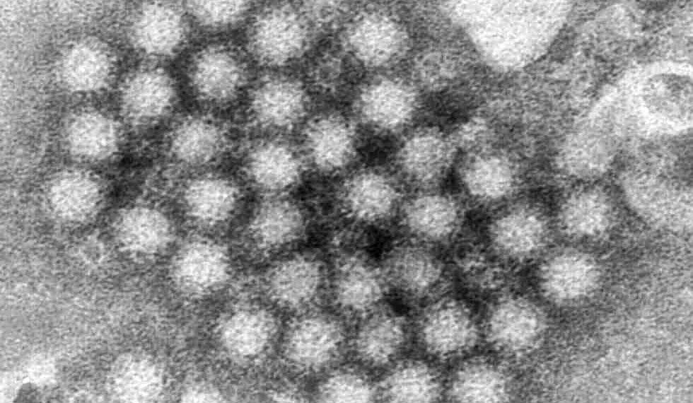Understanding Norovirus: A Guide to Symptoms, Risks, and Prevention - (Charles D. Humphrey/CDC via AP, File)