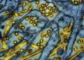 California at the Center of Bird Flu Emergency - AP/National Institute of Allergy and Infectious Diseases