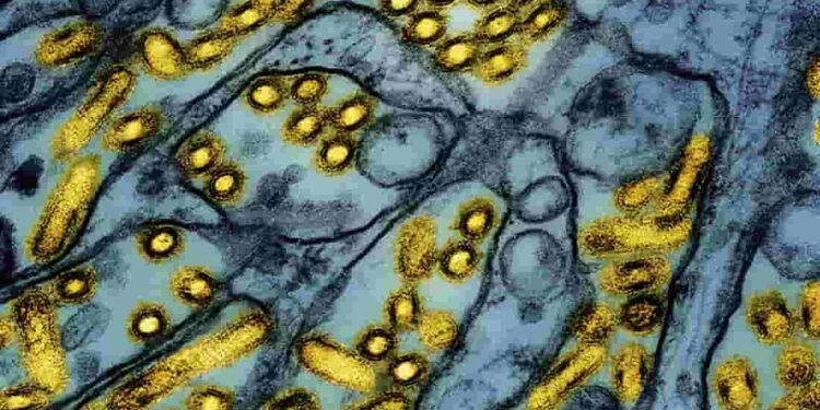 California at the Center of Bird Flu Emergency - AP/National Institute of Allergy and Infectious Diseases