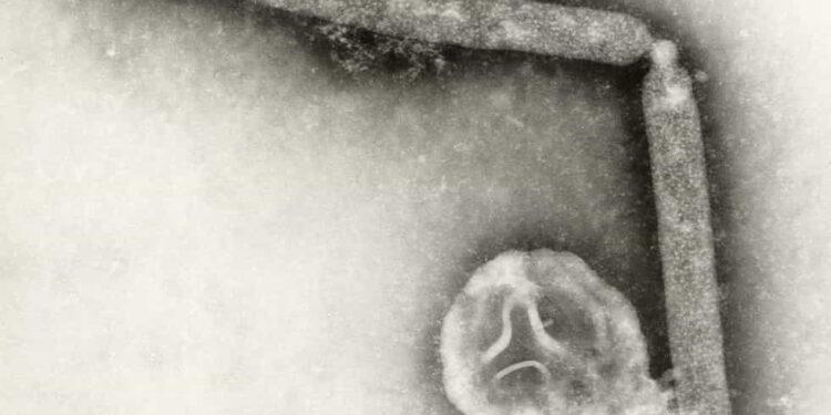 CDC: Bird Flu Virus May Have Changed, But No Human-to-Human Spread Yet- Cynthia Goldsmith, Jackie Katz/CDC via AP, File