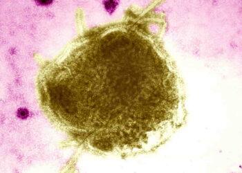 Texas Counties See Growing Measles Outbreak Amid Low Vaccination Rates - BSIP/UIG Via Getty Images