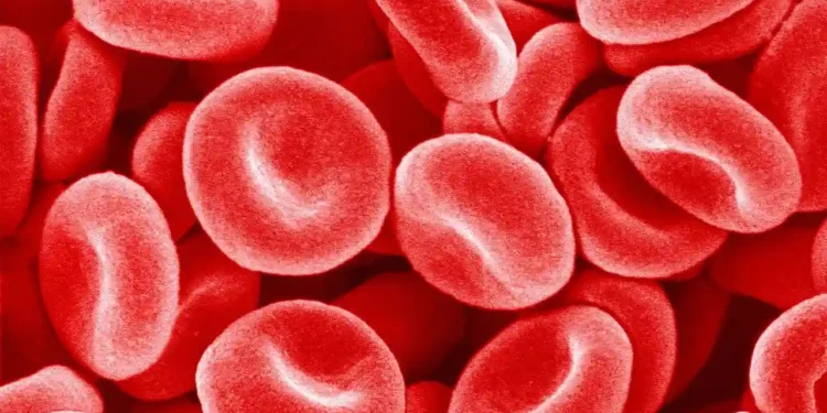Iron Deficiency and Its Hidden Dangers: What You Need to Know - image credit Getty Images via BBC
