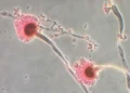 Millions at Risk as Heat-Loving Fungi Expand Across the Globe - Centres for Disease Control/Reuters