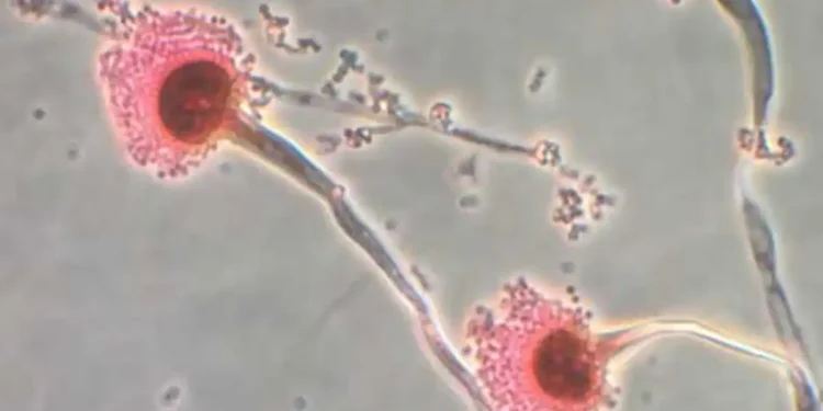 Millions at Risk as Heat-Loving Fungi Expand Across the Globe - Centres for Disease Control/Reuters