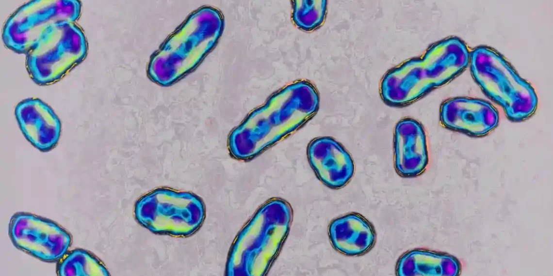 Plague in the U.S.? Arizona Resident Dies from Rare Pneumonic Strain - BSIP/Universal Images Group/Getty Images