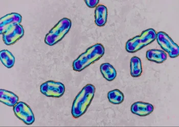 Plague in the U.S.? Arizona Resident Dies from Rare Pneumonic Strain - BSIP/Universal Images Group/Getty Images