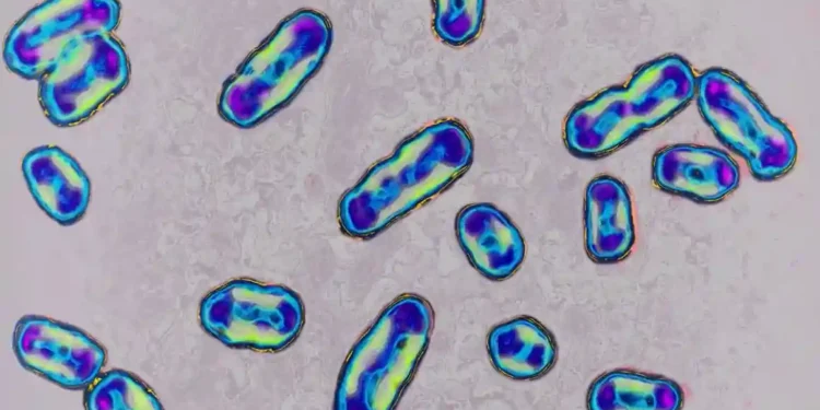 Plague in the U.S.? Arizona Resident Dies from Rare Pneumonic Strain - BSIP/Universal Images Group/Getty Images