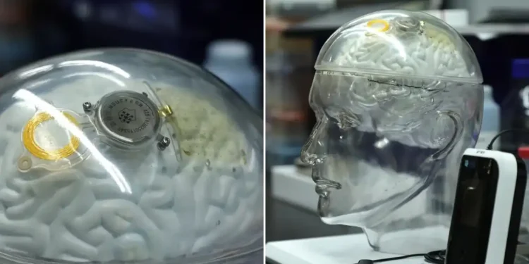 China’s Brain Tech Advances Signal New Rivalry with U.S. in Neural Implants - CNN