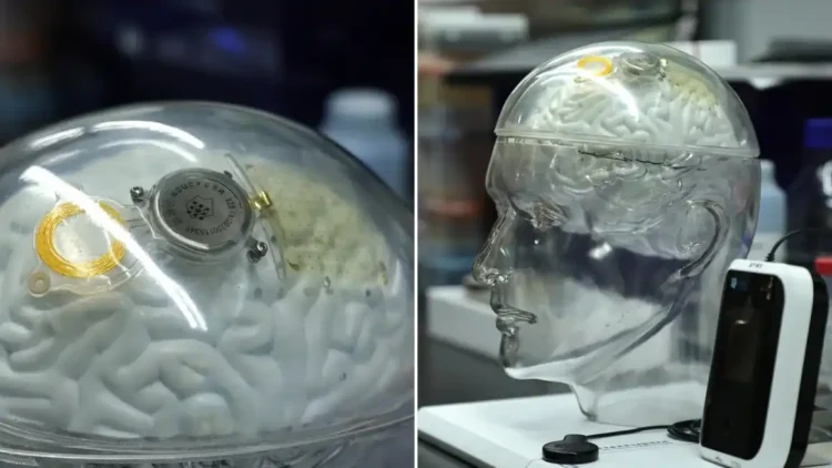 China’s Brain Tech Advances Signal New Rivalry with U.S. in Neural Implants - CNN