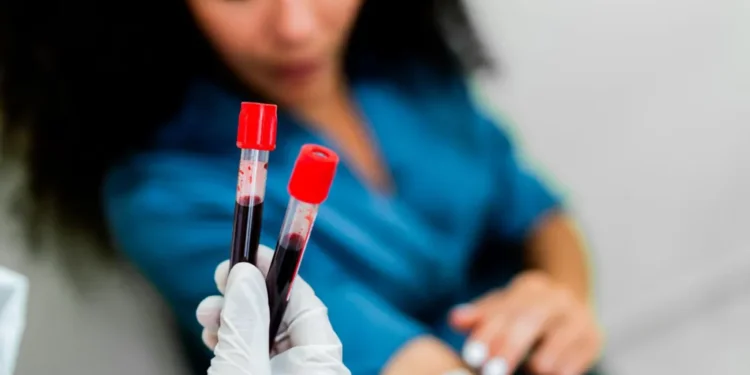 Galleri Blood Test Detects Over 50 Cancer Types in Early Trials - Getty Images