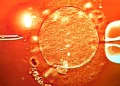 Genetic screening concerns in international sperm donation clinics - Shutterstock/BBC