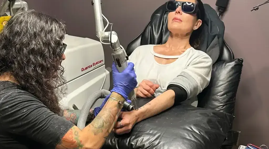 Laser tattoo removal procedure on forearm in professional studio - AP Photo/Corey Williams