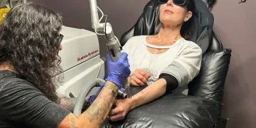 Laser tattoo removal procedure on forearm in professional studio - AP Photo/Corey Williams