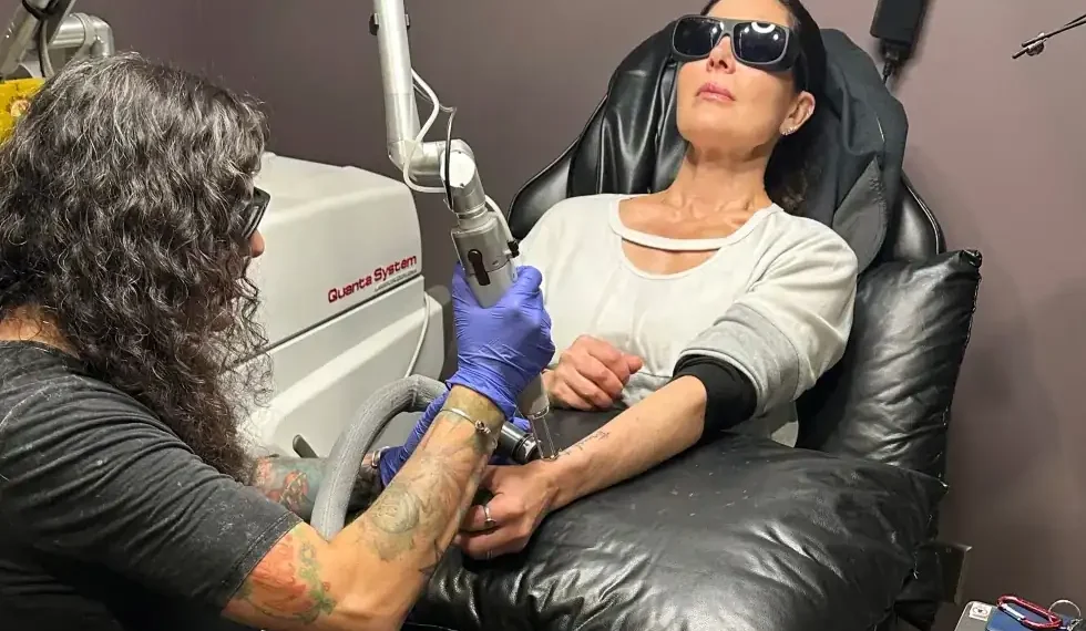 Laser treatment removing tattoo ink from forearm - AP Photo/Corey Williams