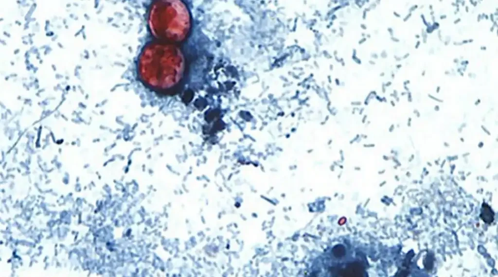 Microscopic image showing Cyclospora cayetanensis oocysts in a stained stool sample used for laboratory diagnosis of cyclosporiasis.