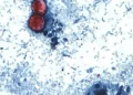 Microscopic image showing Cyclospora cayetanensis oocysts in a stained stool sample used for laboratory diagnosis of cyclosporiasis.