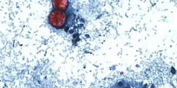 Microscopic image showing Cyclospora cayetanensis oocysts in a stained stool sample used for laboratory diagnosis of cyclosporiasis.