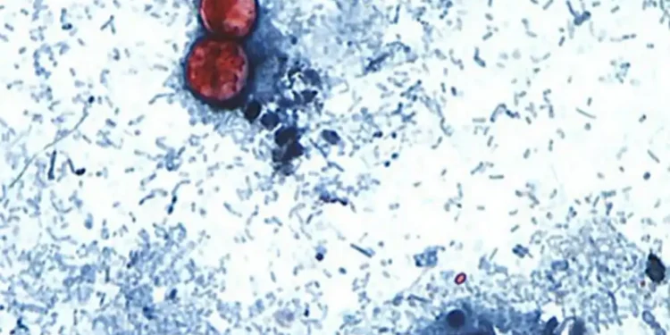 Microscopic image showing Cyclospora cayetanensis oocysts in a stained stool sample used for laboratory diagnosis of cyclosporiasis.