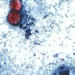 Microscopic image showing Cyclospora cayetanensis oocysts in a stained stool sample used for laboratory diagnosis of cyclosporiasis.