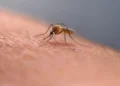 Person scratching a mosquito bite on their arm outdoors - AP Photo/Rick Bowmer, File