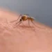 Person scratching a mosquito bite on their arm outdoors - AP Photo/Rick Bowmer, File