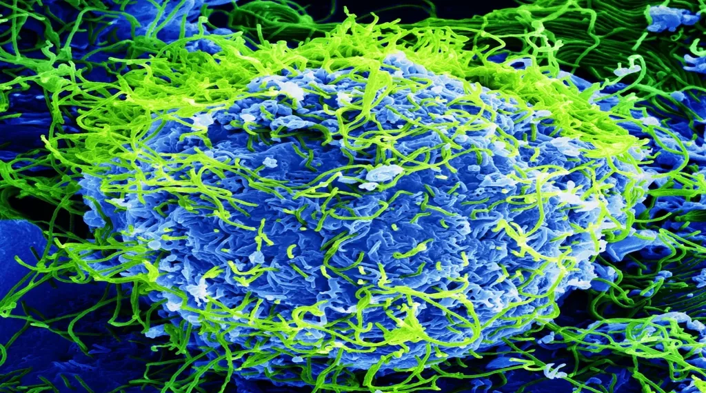 Colorized scanning electron micrograph showing Ebola virus particles budding from an infected African green monkey kidney cell at 20,000× magnification.