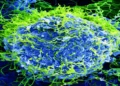 Colorized scanning electron micrograph showing Ebola virus particles budding from an infected African green monkey kidney cell at 20,000× magnification.