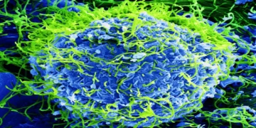 Colorized scanning electron micrograph showing Ebola virus particles budding from an infected African green monkey kidney cell at 20,000× magnification.