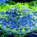 Colorized scanning electron micrograph showing Ebola virus particles budding from an infected African green monkey kidney cell at 20,000× magnification.