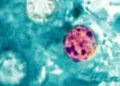 Photomicrograph showing four Cyclospora cayetanensis oocysts in a stained fresh stool sample examined under a microscope.