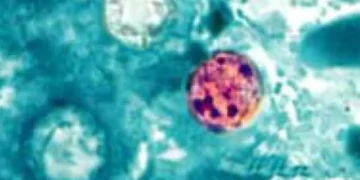 Photomicrograph showing four Cyclospora cayetanensis oocysts in a stained fresh stool sample examined under a microscope.