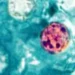 Photomicrograph showing four Cyclospora cayetanensis oocysts in a stained fresh stool sample examined under a microscope.