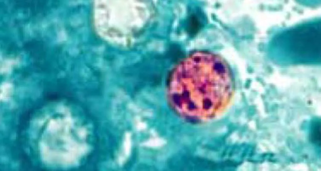 Photomicrograph showing four Cyclospora cayetanensis oocysts in a stained fresh stool sample examined under a microscope.