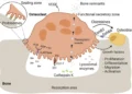 Scientific illustration showing osteoclast-mediated bone resorption and signaling pathways that support bone replacement by osteoblasts.