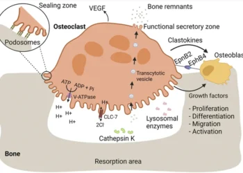Scientific illustration showing osteoclast-mediated bone resorption and signaling pathways that support bone replacement by osteoblasts.